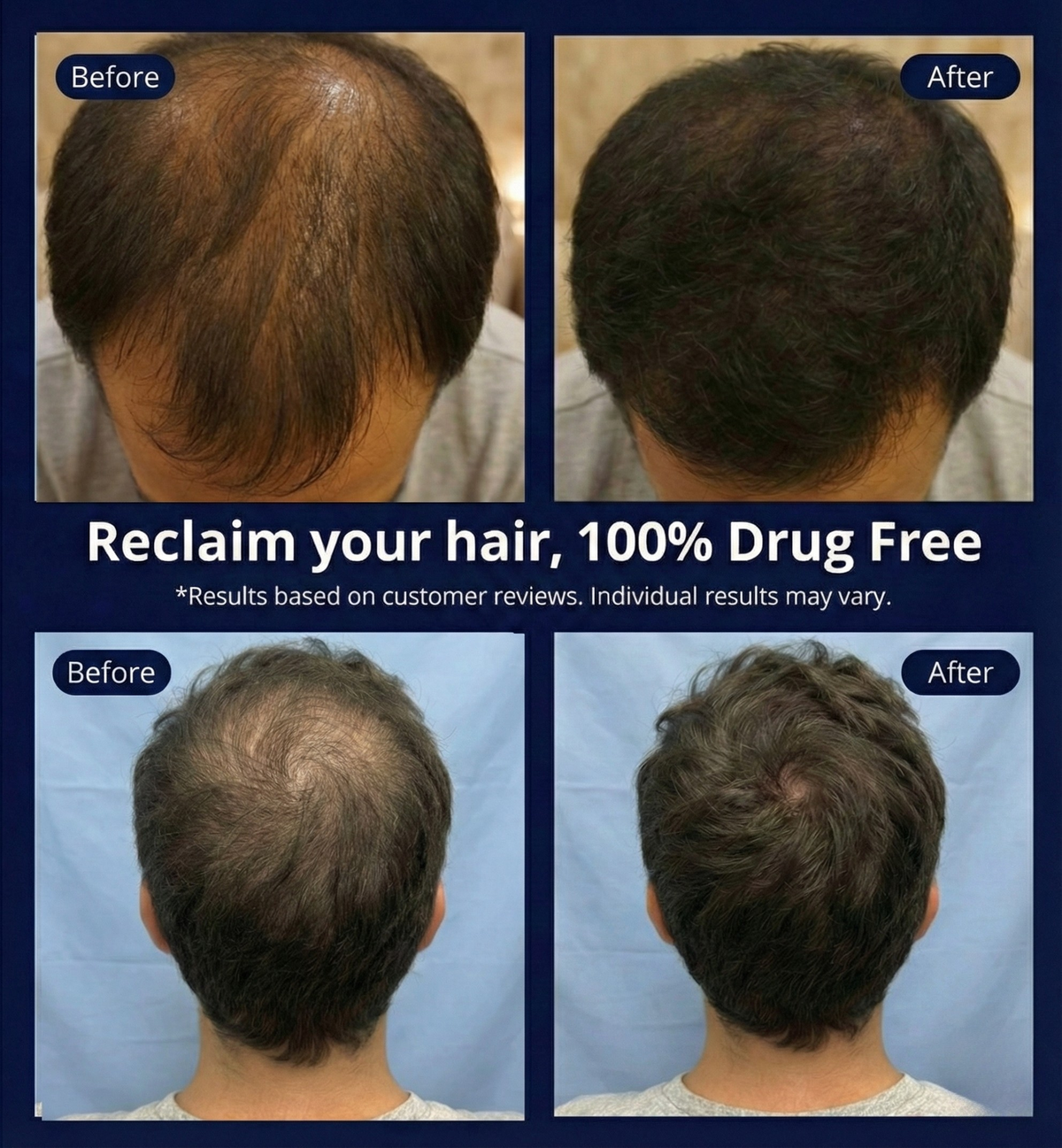 Luma Red Light Therapy Cap - Professional Hair Growth & Scalp Treatment