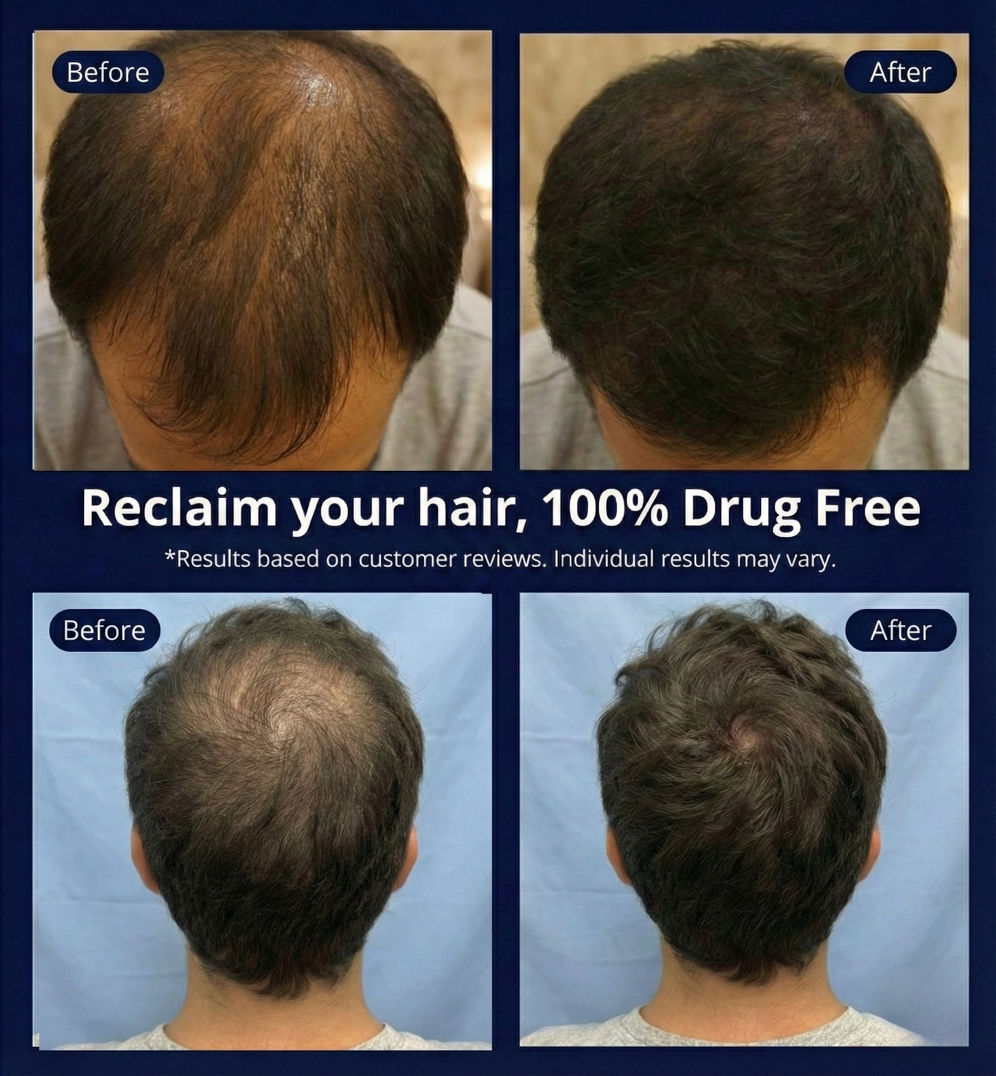 Luma Red Light Therapy Cap - Professional Hair Growth & Scalp Treatment